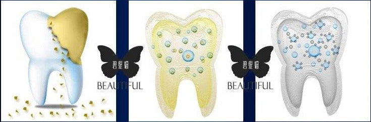 Beautiful Smile® Zahnaufhellungsset